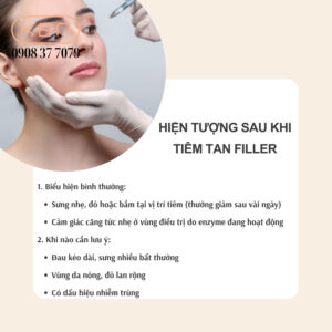 tiem-tan-filler-nen-kieng-gi