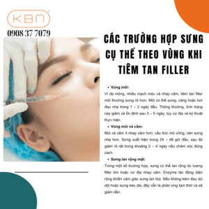cach-giam-sung-sau-khi-tiem-tan-filler