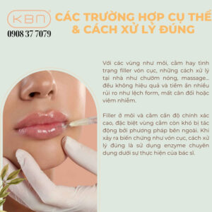 chuom-nong-co-lam-tan-filler