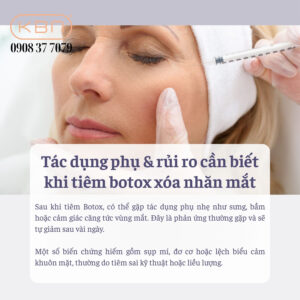ky-thuat-tiem-botox-vung-mat