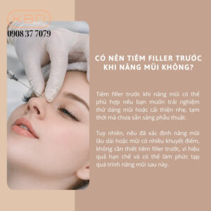 nang-mui-xong-tiem-filler-duoc-khong