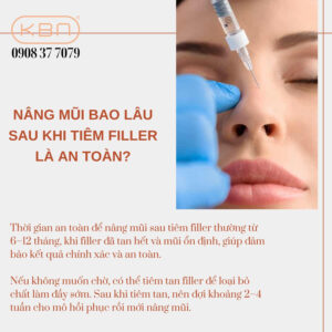 nen-tiem-filler-mui-hay-nang-mui