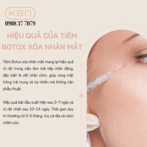 tiem-botox-duoi-mat
