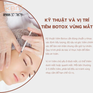 tiem-botox-duoi-mat-bi-do