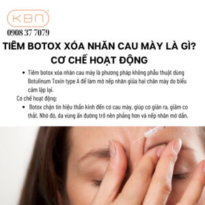 tiem-botox-xoa-nhan-cau-may