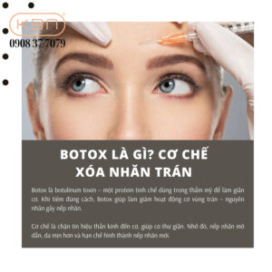 tiem-botox-xoa-nhan-tran