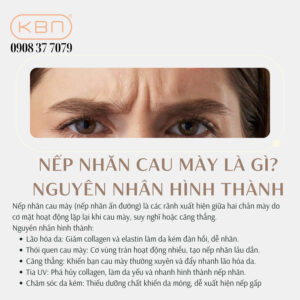 tiem-botox-xoa-nhan-tran-gia-bao-nhieu