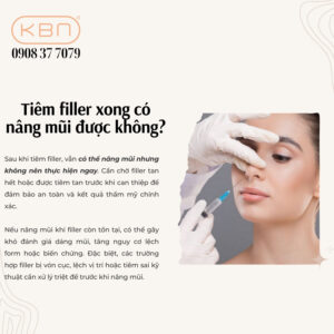tiem-filler-xong-co-nang-mui-duoc-khong