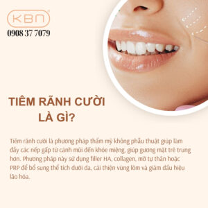 tiem-ranh-cuoi