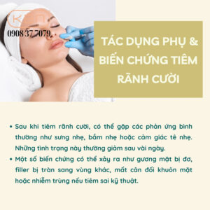 tiem-ranh-cuoi-bang-filler-cung-hay-mem