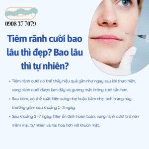 tiem-ranh-cuoi-co-kieng-cuoi-khong