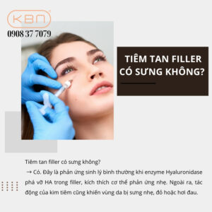 tiem-tan-filler-bao-lau-thi-het-sung