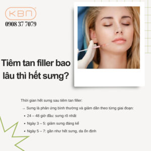 tiem-tan-filler-bi-sung-co-sao-khong