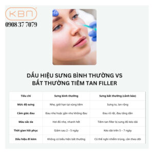 tiem-tan-filler-co-sung-khong