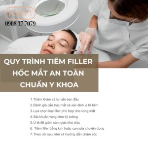 co-nen-tiem-filler-hoc-mat