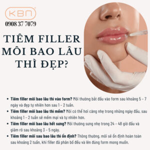 co-nen-tiem-filler-moi-khong