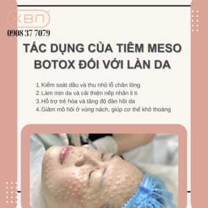 meso-botox-kiem-dau