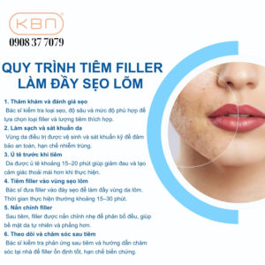 seo-lom-co-tiem-filler-duoc-khong