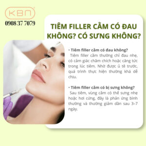 tiem-filler-cam-can-kieng-gi
