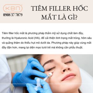 tiem-filler-hoc-mat