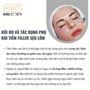 tiem-filler-lam-day-seo
