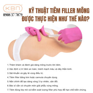 tiem-filler-mong-bao-lau-thi-mem