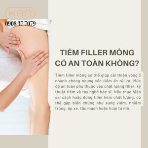 tiem-filler-mong-gia-bao-nhieu