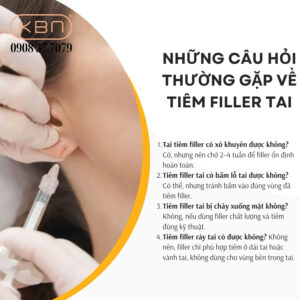 tiem-filler-tai-kieng-gi