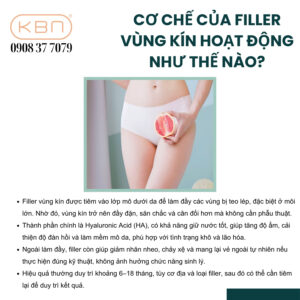 tiem-filler-vung-kin