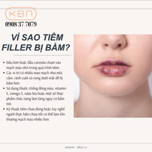 cach-lam-tan-vet-bam-khi-tiem-filler