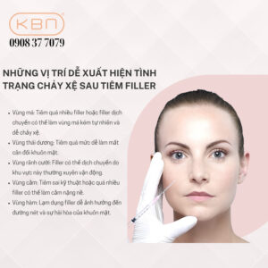 da-chay-xe-do-tiem-filler