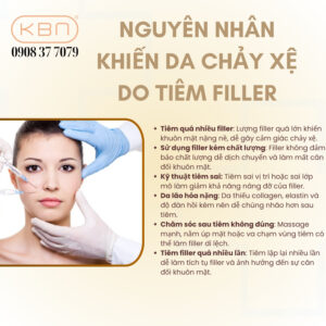 mat-chay-xe-do-tiem-filler