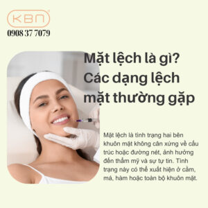 mat-lech-co-tiem-filler-duoc-khong