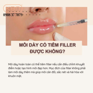moi-day-co-tiem-filler-duoc-khong