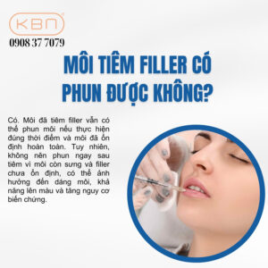 moi-tiem-filler-co-phun-duoc-khong