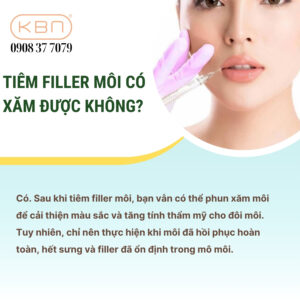 moi-tiem-filler-co-phun-moi-duoc-khong