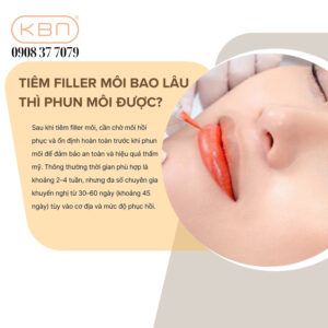 nen-tiem-filler-truoc-hay-phun-moi-truoc