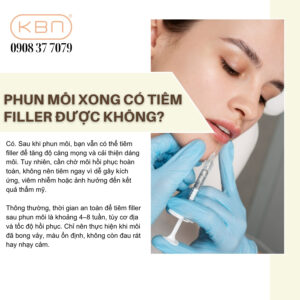 phun-moi-bao-lau-thi-tiem-filler-duoc
