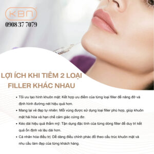 tiem-2-loai-filler-khac-nhau