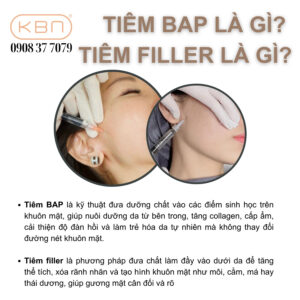 tiem-bap-co-phai-la-filler-khong