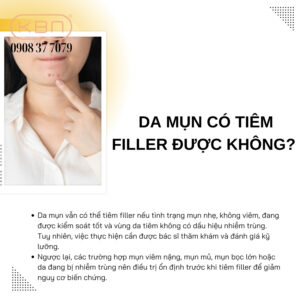 tiem-filler-bao-lau-duoc-nan-mun