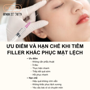 tiem-filler-chua-mat-lech