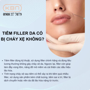 tiem-filler-da-co-bi-chay-xe-khong