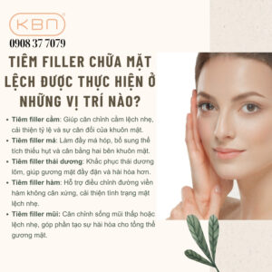 tiem-filler-mat-lech-gia-bao-nhieu