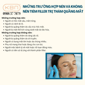 tiem-filler-quang-tham-mat-gia-bao-nhieu