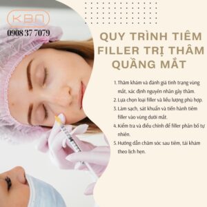 tiem-filler-tri-tham-quang-mat
