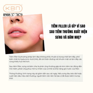 tiem-filler-xong-co-nen-chuom-da