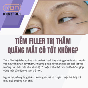 tiem-tan-quang-tham-mat