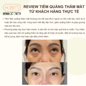tiem-tri-tham-quang-mat-gia-bao-nhieu