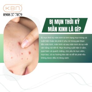 bi-mun-thoi-ky-man-kinh